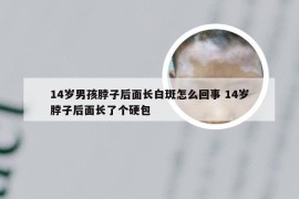 14岁男孩脖子后面长白斑怎么回事 14岁脖子后面长了个硬包