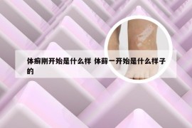 体癣刚开始是什么样 体藓一开始是什么样子的