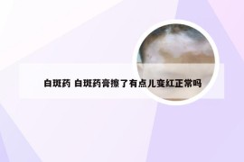 白斑药 白斑药膏擦了有点儿变红正常吗