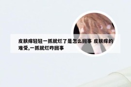 皮肤痒轻轻一抓就烂了是怎么回事 皮肤痒的难受,一抓就烂咋回事