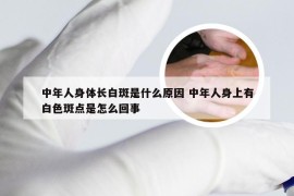 中年人身体长白斑是什么原因 中年人身上有白色斑点是怎么回事