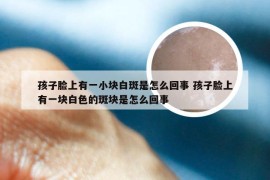 孩子脸上有一小块白斑是怎么回事 孩子脸上有一块白色的斑块是怎么回事