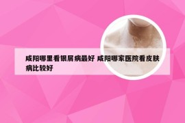 咸阳哪里看银屑病最好 咸阳哪家医院看皮肤病比较好