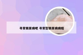 寻常银屑病吧 寻常型银屑病病程