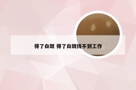 得了白斑 得了白斑找不到工作