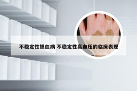 不稳定性银血病 不稳定性高血压的临床表现