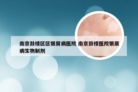 南京鼓楼区区银屑病医院 南京鼓楼医院银屑病生物制剂