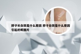 脖子长白斑是什么原因 脖子白斑是什么原因引起的呢图片