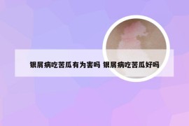 银屑病吃苦瓜有为害吗 银屑病吃苦瓜好吗