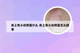 身上有小白斑是什么 身上有小白斑是怎么回事