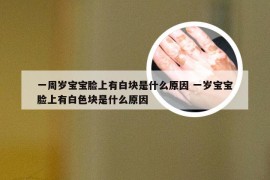 一周岁宝宝脸上有白块是什么原因 一岁宝宝脸上有白色块是什么原因