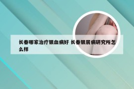 长春哪家治疗银血病好 长春银屑病研究所怎么样