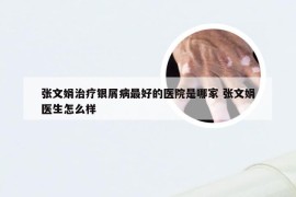 张文娟治疗银屑病最好的医院是哪家 张文娟医生怎么样