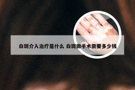 白斑介入治疗是什么 白斑做手术需要多少钱