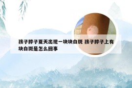 孩子脖子夏天出现一块块白斑 孩子脖子上有块白斑是怎么回事