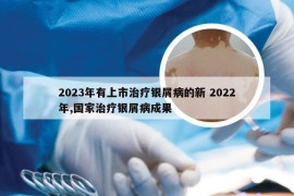 2023年有上市治疗银屑病的新 2022年,国家治疗银屑病成果