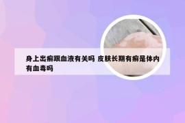 身上出癣跟血液有关吗 皮肤长期有癣是体内有血毒吗