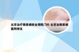 北京治疗银屑病安全得胜门约 北京治银屑病医院排名