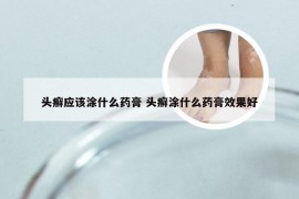 头癣应该涂什么药膏 头癣涂什么药膏效果好