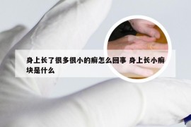 身上长了很多很小的癣怎么回事 身上长小癣块是什么