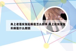 身上老是反复起癣是怎么回事 身上反反复复长癣是什么原因