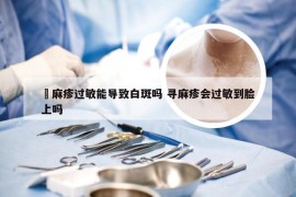 尋麻疹过敏能导致白斑吗 寻麻疹会过敏到脸上吗