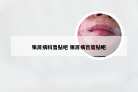 银屑病科普贴吧 银屑病百度贴吧