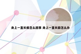 身上一直长癣怎么回事 身上一直长藓怎么办