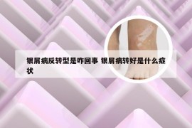 银屑病反转型是咋回事 银屑病转好是什么症状