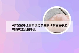 4岁宝宝手上有白斑怎么回事 4岁宝宝手上有白斑怎么回事儿