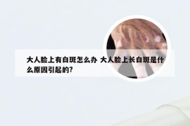 大人脸上有白斑怎么办 大人脸上长白斑是什么原因引起的?