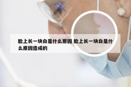 脸上长一块白是什么原因 脸上长一块白是什么原因造成的