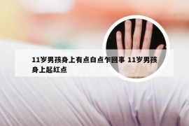 11岁男孩身上有点白点乍回事 11岁男孩身上起红点