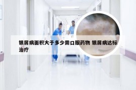 银屑病面积大于多少需口服药物 银屑病达标治疗