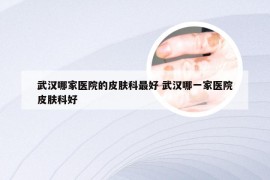 武汉哪家医院的皮肤科最好 武汉哪一家医院皮肤科好