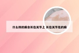 什么样的癣会长在关节上 长在关节处的癣