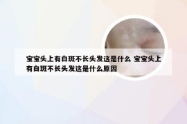 宝宝头上有白斑不长头发这是什么 宝宝头上有白斑不长头发这是什么原因