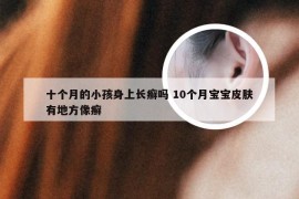 十个月的小孩身上长癣吗 10个月宝宝皮肤有地方像癣