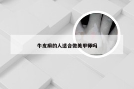 牛皮癣的人适合做美甲师吗