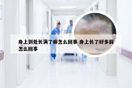 身上到处长满了癣怎么回事 身上长了好多藓怎么回事