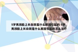 5岁男孩脸上长白斑是什么原因引起的 5岁男孩脸上长白斑是什么原因引起的怎么治疗