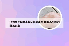 化妆品导致脸上长白斑怎么办 化妆品引起的斑怎么治