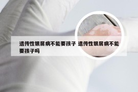 遗传性银屑病不能要孩子 遗传性银屑病不能要孩子吗