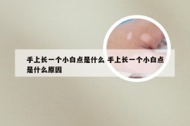 手上长一个小白点是什么 手上长一个小白点是什么原因