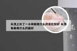 头顶上长了一小块癣用什么药膏比较好 头顶有癣用什么药最好