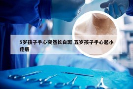 5岁孩子手心突然长白斑 五岁孩子手心起小疙瘩