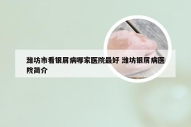 潍坊市看银屑病哪家医院最好 潍坊银屑病医院简介