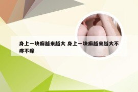 身上一块癣越来越大 身上一块癣越来越大不疼不痒