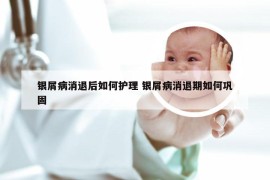 银屑病消退后如何护理 银屑病消退期如何巩固