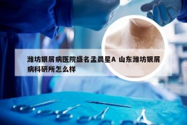 潍坊银屑病医院盛名孟晨星A 山东潍坊银屑病科研所怎么样